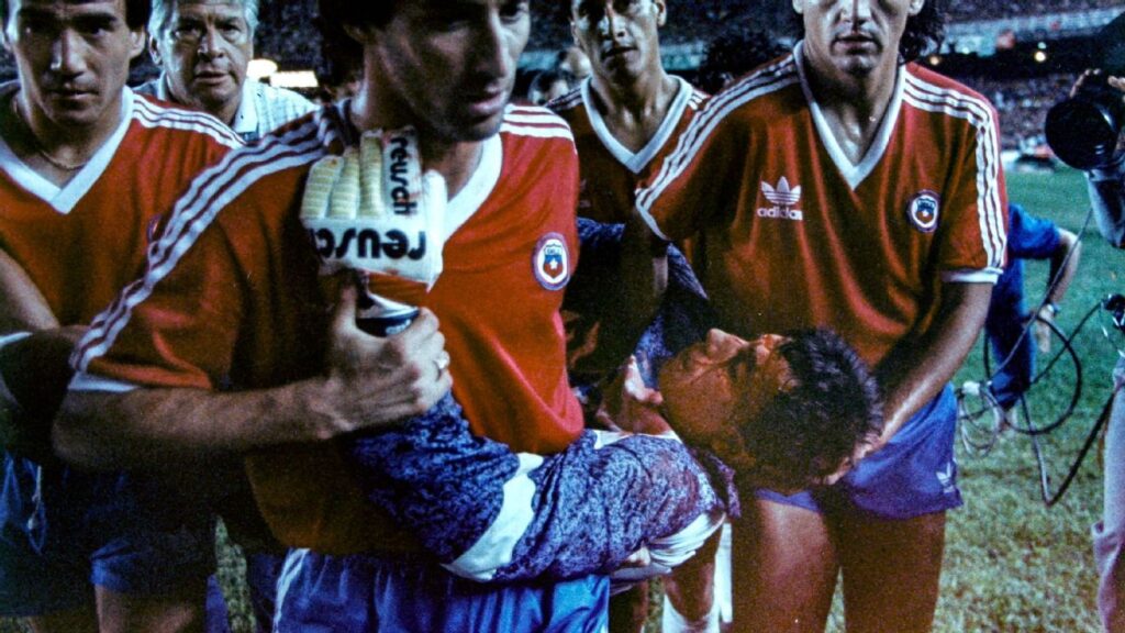 Chile goalkeeper Roberto Rojas faking injury with hidden razor blade in 1989.